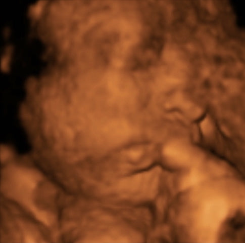 Pregnancy Week image