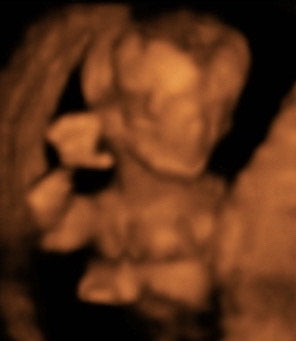 Pregnancy Week image