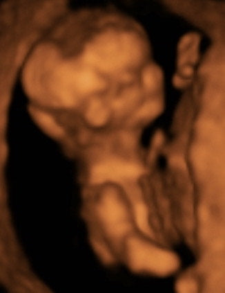Pregnancy Week image
