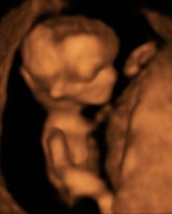 Pregnancy Week image