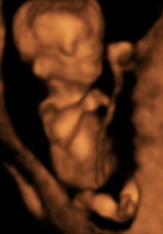 Pregnancy Week image