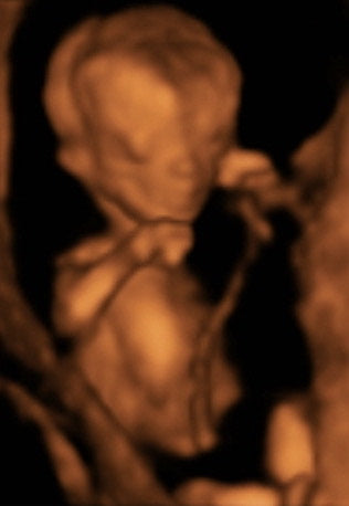 Pregnancy Week image