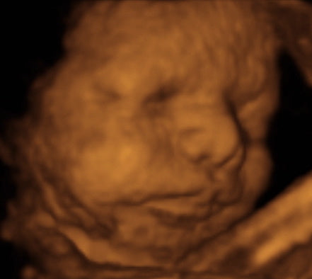 Pregnancy Week image