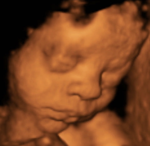 Pregnancy Week image
