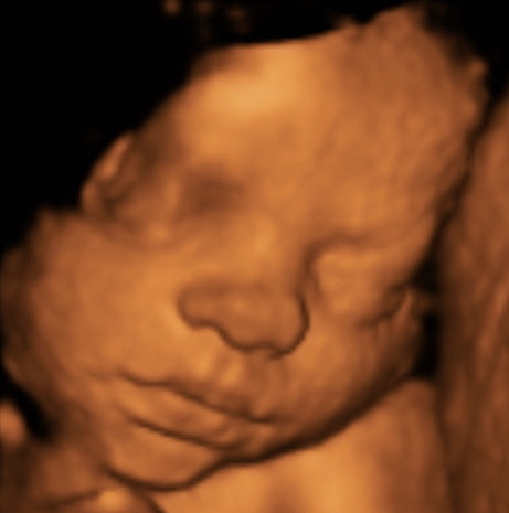 Pregnancy Week image