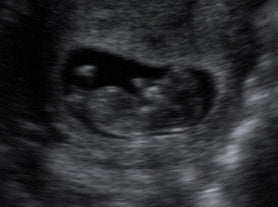 Pregnancy Week image