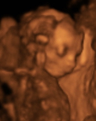 Pregnancy Week image