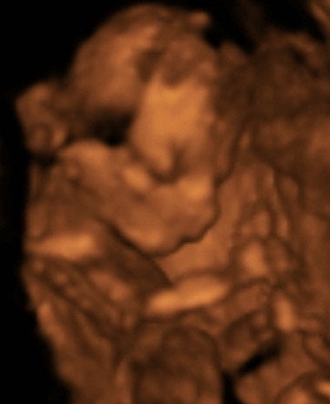 Pregnancy Week image