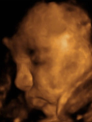 Pregnancy Week image