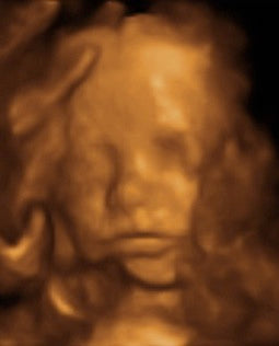 Pregnancy Week image