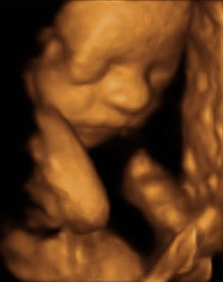Pregnancy Week image