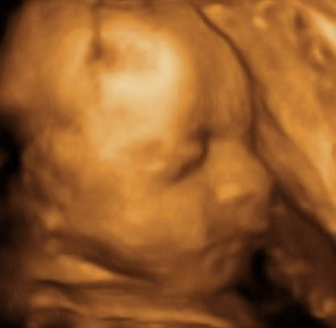 Pregnancy Week image