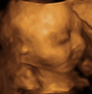 Pregnancy Week image