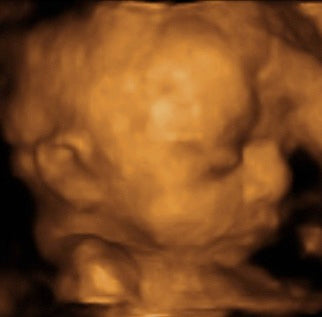 Pregnancy Week image
