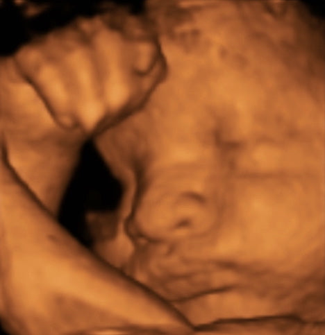 Pregnancy Week image