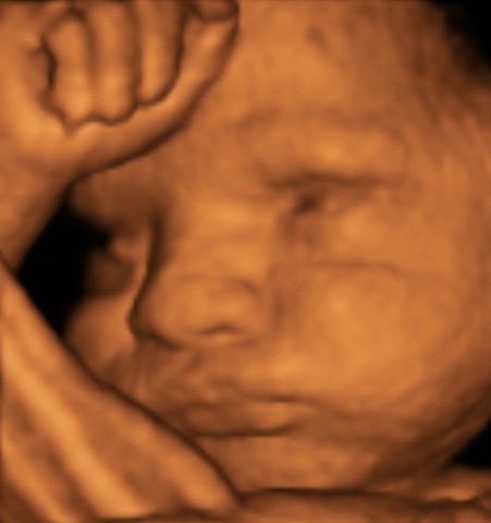 Pregnancy Week image
