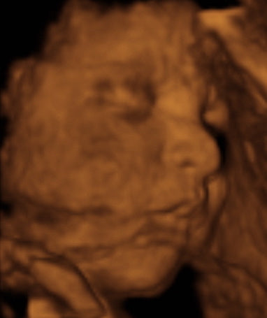 Pregnancy Week image