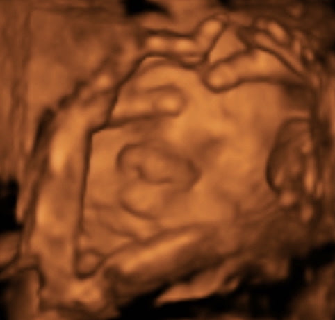 Pregnancy Week image