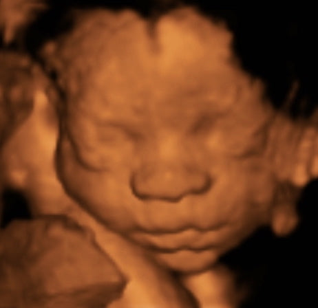 Pregnancy Week image