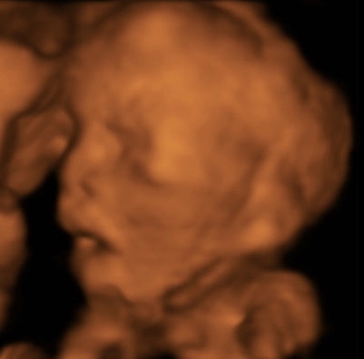 Pregnancy Week image