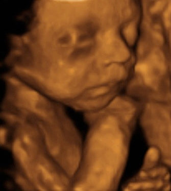 Pregnancy Week image