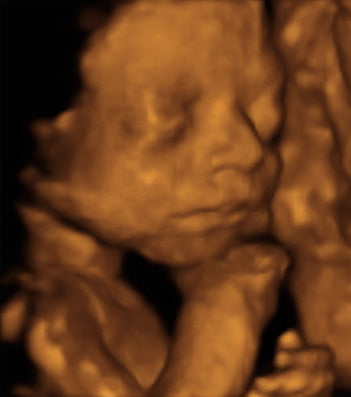 Pregnancy Week image