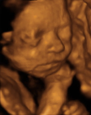 Pregnancy Week image