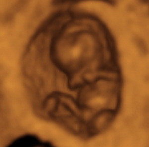 Pregnancy Week image