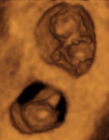Pregnancy Week image