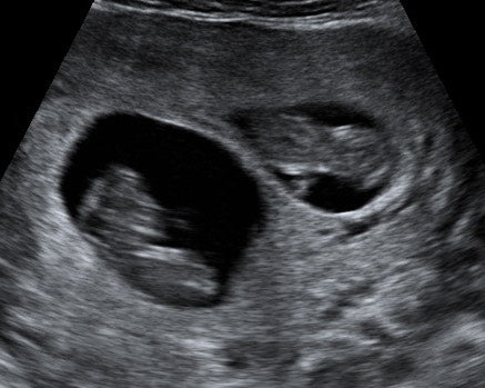 Pregnancy Week image
