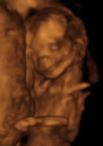 Pregnancy Week image