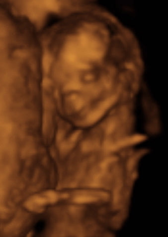 Pregnancy Week image