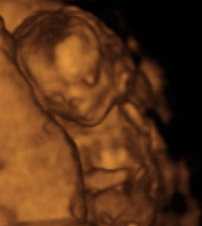 Pregnancy Week image