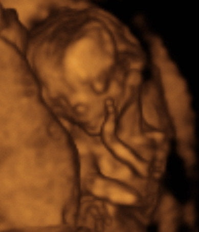 Pregnancy Week image