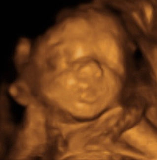 Pregnancy Week image