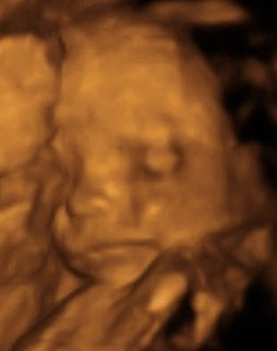 Pregnancy Week image
