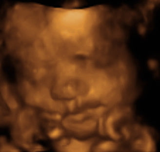 Pregnancy Week image
