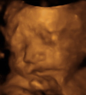 Pregnancy Week image
