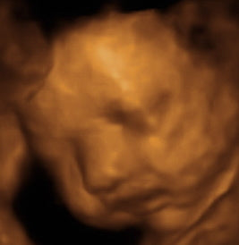 Pregnancy Week image