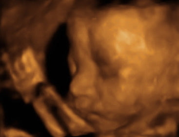 Pregnancy Week image