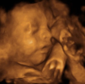 Pregnancy Week image