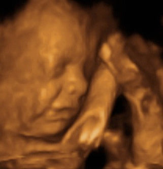 Pregnancy Week image