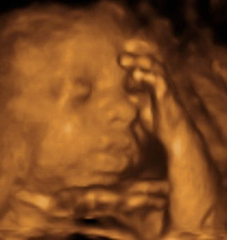 Pregnancy Week image