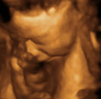 Pregnancy Week image