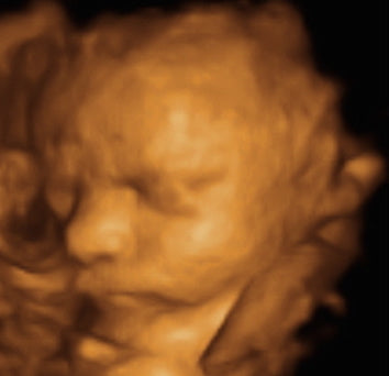 Pregnancy Week image