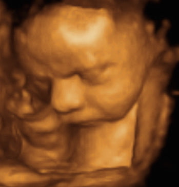 Pregnancy Week image