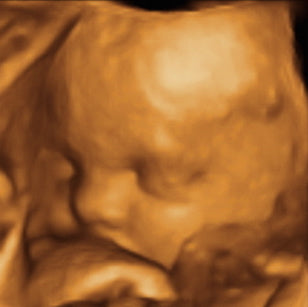 Pregnancy Week image
