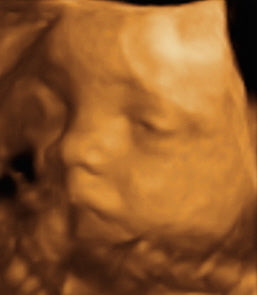 Pregnancy Week image