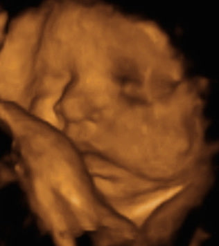 Pregnancy Week image