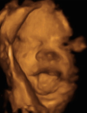 Pregnancy Week image